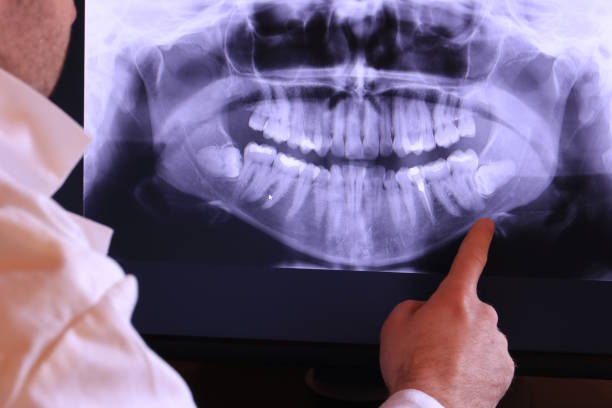 Best Emergency Gum Pain Relief  in Timberne, LA